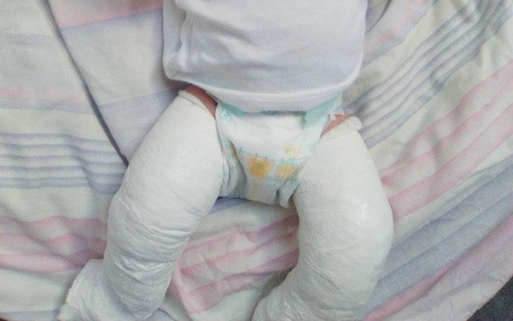 Zbiórka nóżki Ksawerego - zdjęcie główne