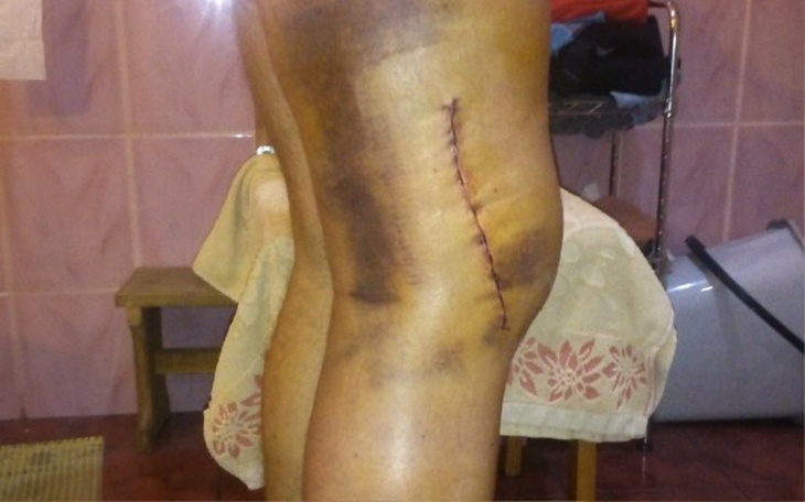 Zbiórka Operacje kolan i bioder - zdjęcie główne