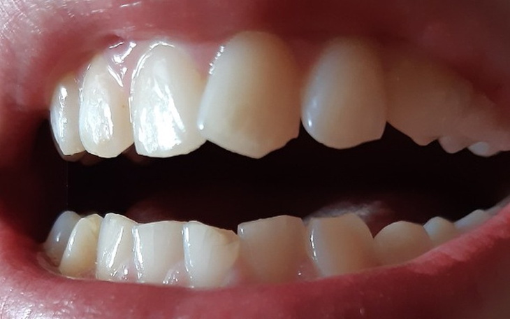 Zbiórka Marzenie proste zęby - zdjęcie główne