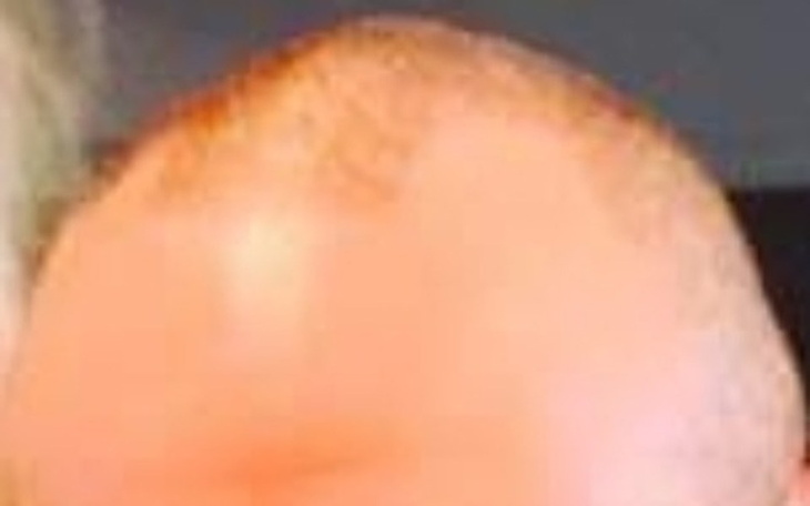 Zbiórka Fryzjer dla Malutkiego - zdjęcie główne