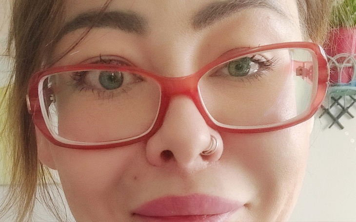 Zbiórka Okulary po operacji orbitopatii - zdjęcie główne