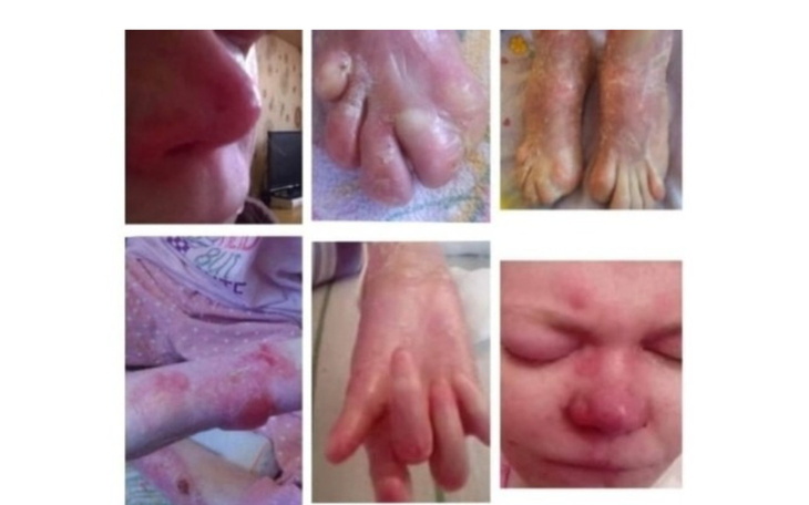 Zdjęcia ran i zmian skórnych, problem zdrowotny.