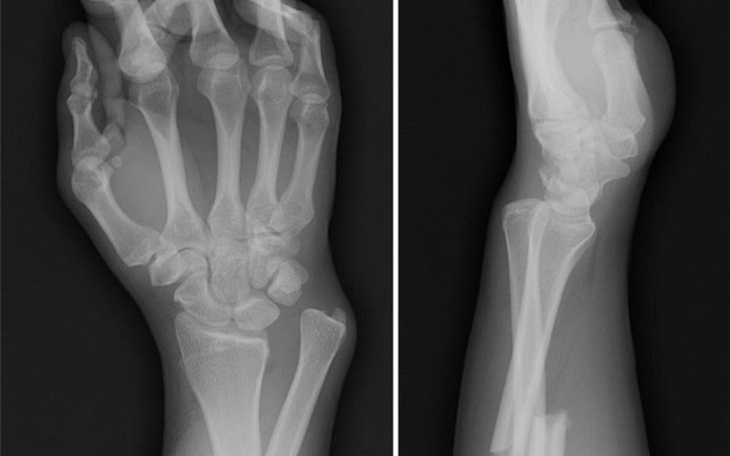 Zbiórka Komputer albo laptop - zdjęcie główne