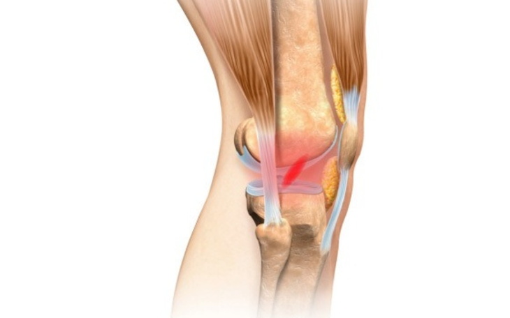 Zbiórka Powrót na boisko ACL - zdjęcie główne