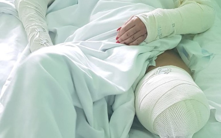 Zbiórka Na rehabilitację i protezę nogi - zdjęcie główne