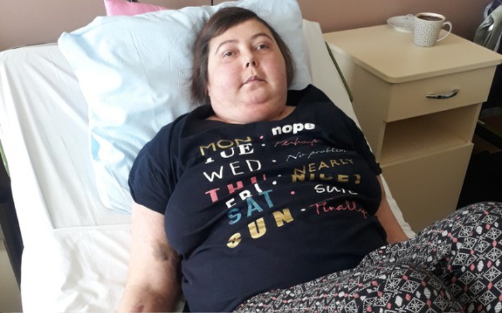 Zbiórka Rehabilitacja Katarzyny ! - zdjęcie główne