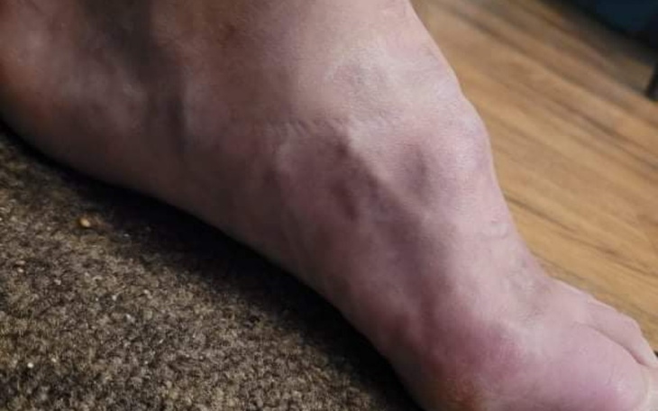 Zbiórka Operacja stopy... - zdjęcie główne