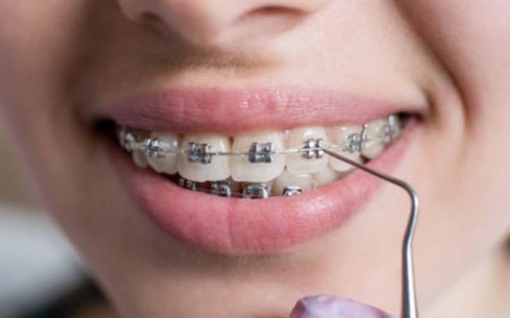 Zbiórka Pomoc W Leczeniu Wady Zgryzu - zdjęcie główne