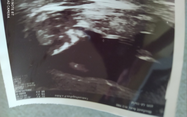 Zbiórka Pilnie potrzebna pomoc finansowo - zdjęcie główne