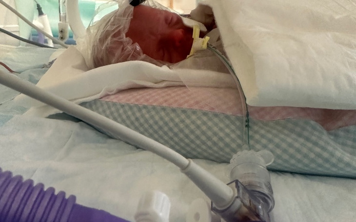 Noworodek w inkubatorze, z rurkami medycznymi.