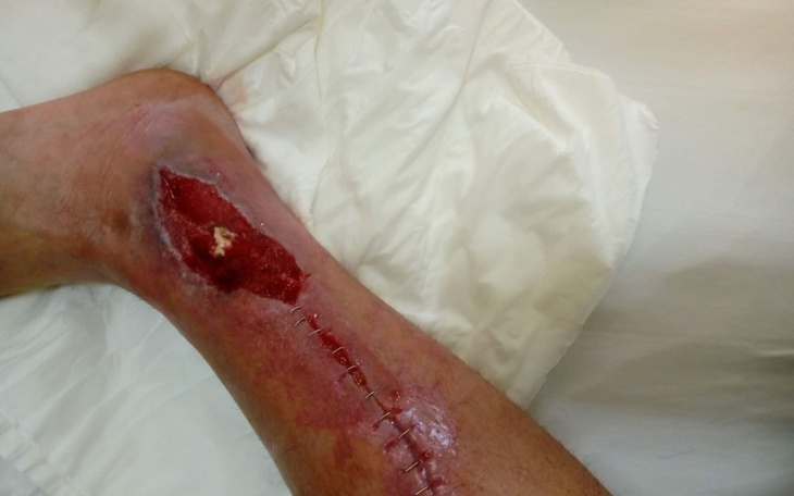 Zbiórka Na zycie codziennee - zdjęcie główne