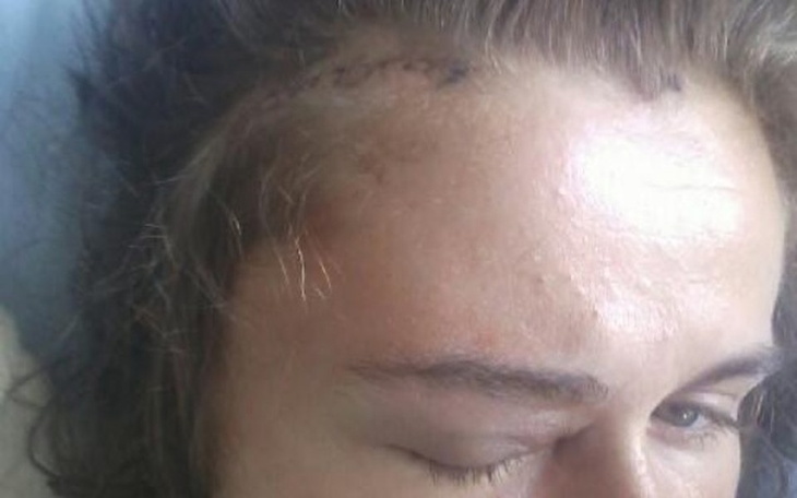 Zbiórka Leczenie po operacji - zdjęcie główne