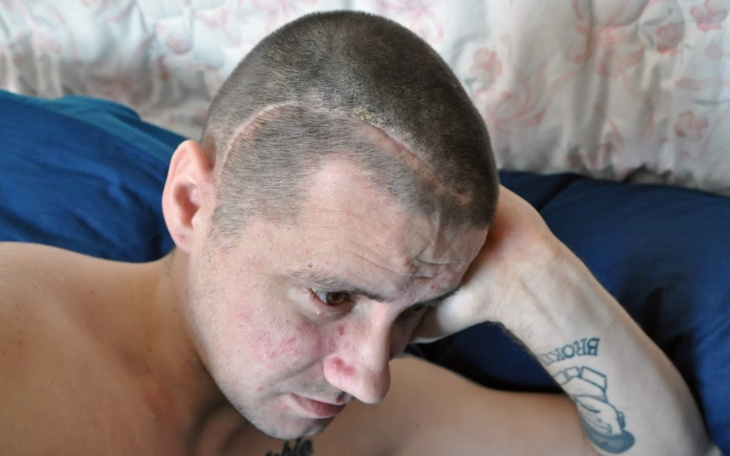 Zbiórka Na życie z glejakiem - zdjęcie główne