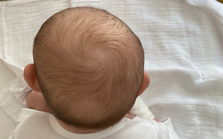 Zbiórka Terapia kaskowa dla Leosia - zdjęcie główne