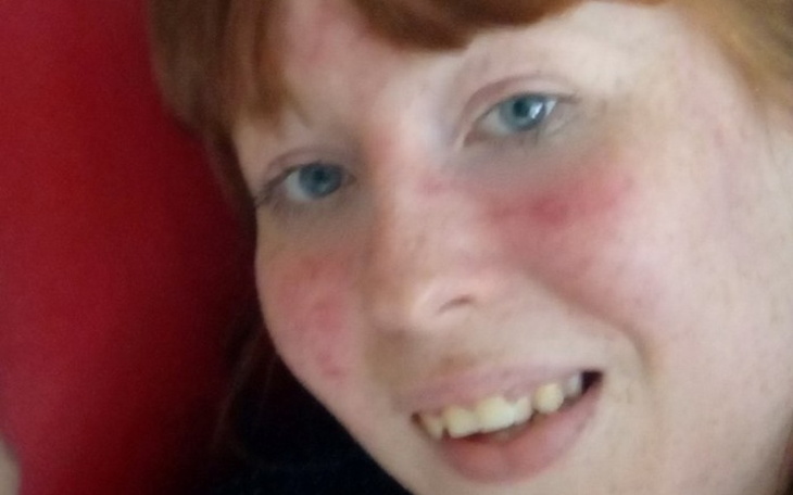 Zbiórka Hashimoto - zdjęcie główne