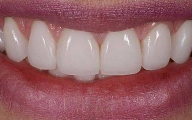 Zbiórka Rekonstrukcja twarzy po wypadku - zdjęcie główne