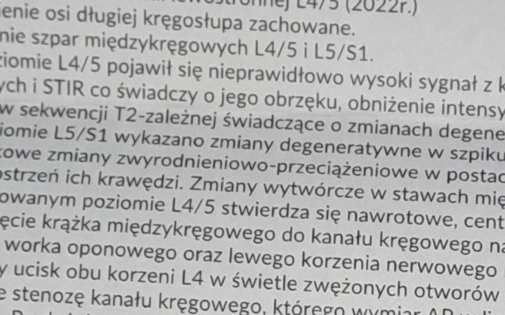 Zbiórka Leczenie kręgosłupa. - zdjęcie główne
