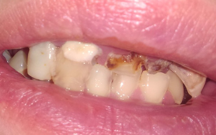 Zbiórka Na Dentyste - zdjęcie główne