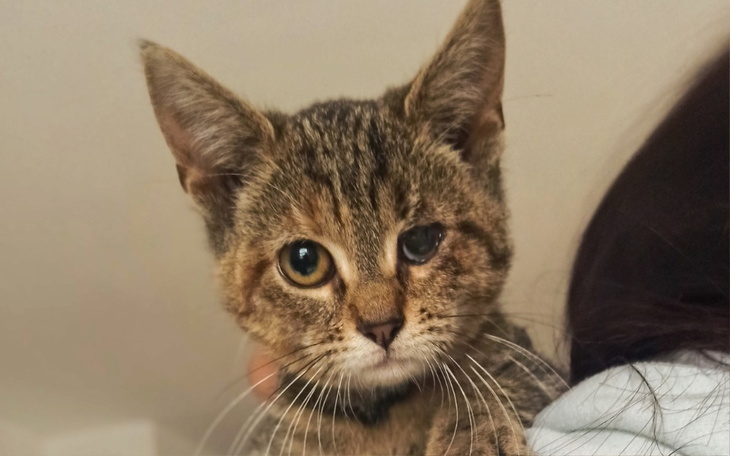 Zbiórka Zabieg korekty powieki Basi - zdjęcie główne