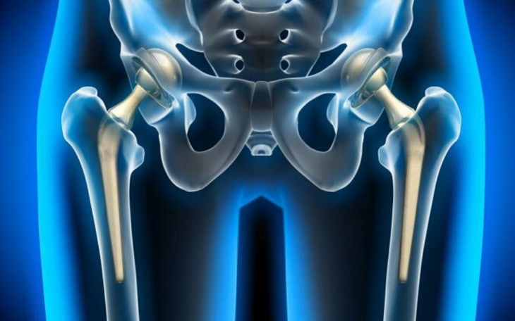 Zbiórka Dwie operacje biodra i kolana - zdjęcie główne