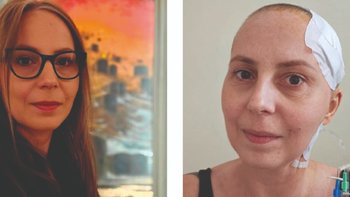 Zbiórka Glejak. Potrzebuję planu B. Podaruj mi kontynuację leczenia - miniaturka zdjęcia
