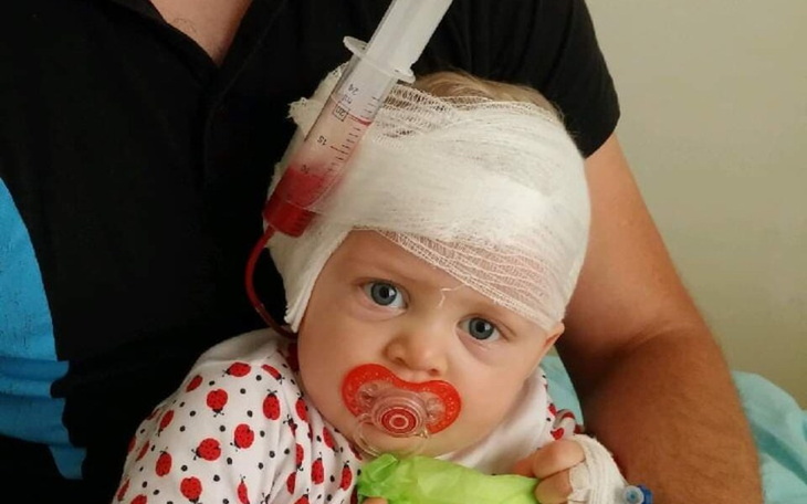 Zbiórka Implant Ślimakowy. - zdjęcie główne