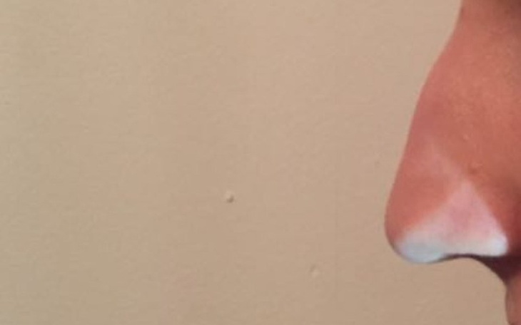 Zbiórka Wymarzona Operacja Mojego Nosa - zdjęcie główne