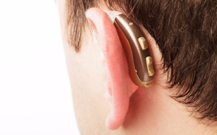 Zbiórka Aparat sl - zdjęcie główne