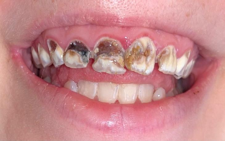 Zbiórka To Na zdrowy piękny uśmiech - zdjęcie główne