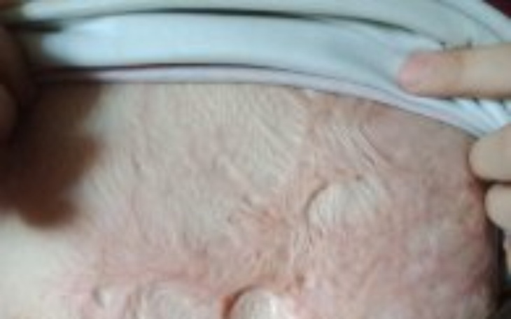 Zbiórka pomoc w zbiórce naoperację - zdjęcie główne