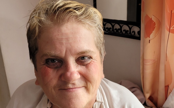 Zbiórka Leczenie,Rehabilitacja,Sprzęt me - zdjęcie główne