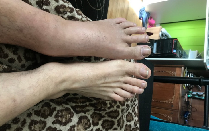 Zbiórka pomoc na leczenie po wypadku - zdjęcie główne