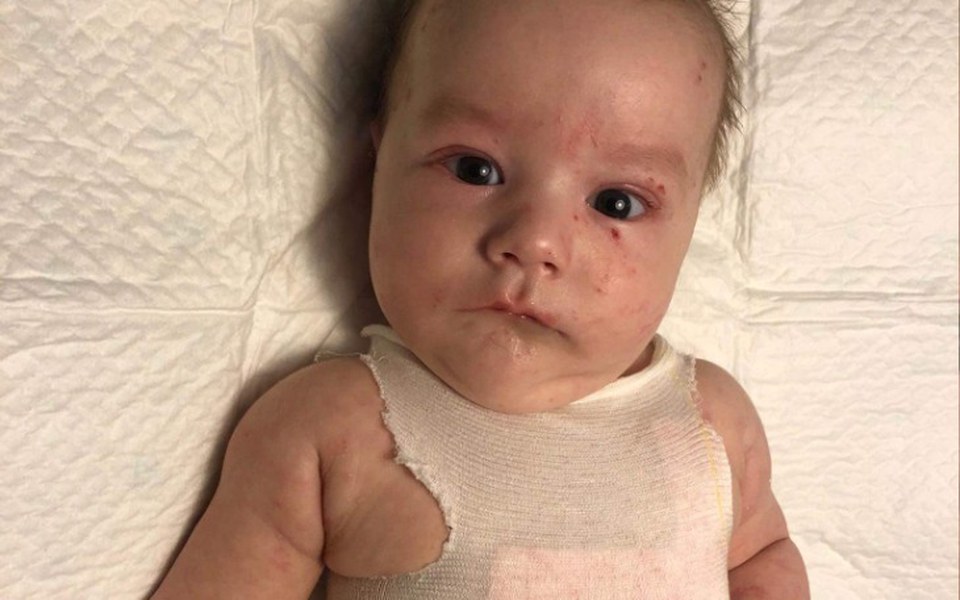 Zbiórka Pomoc dla Frania z Trzebnicy - zdjęcie główne