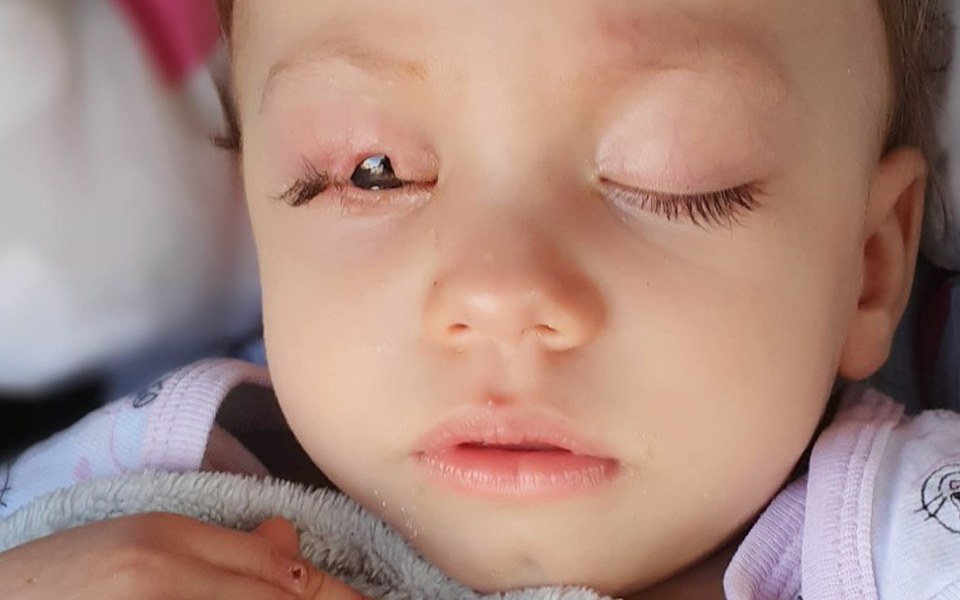 
        Zbiórka Rehabilitacja i leczenie Zuzi - zdjęcie główne
    