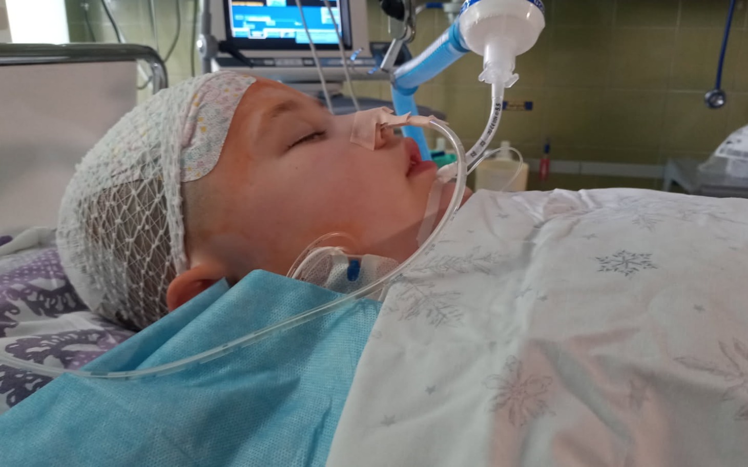 
        Dziecko w szpitalu z rurkami tlenowymi, leżące na łóżku szpitalnym.
    