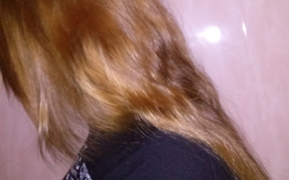 
        Zbiórka Wymarzony Aparat ortodontyczny. - zdjęcie główne
    