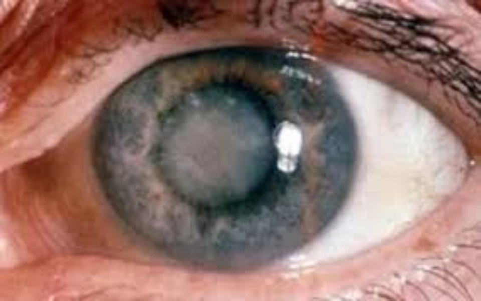 Zbiórka Zaćma u Matki - zdjęcie główne