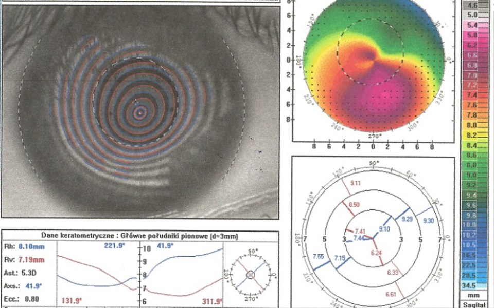 
        Zbiórka Pomoc dla chorego twórcy LMV - zdjęcie główne
    