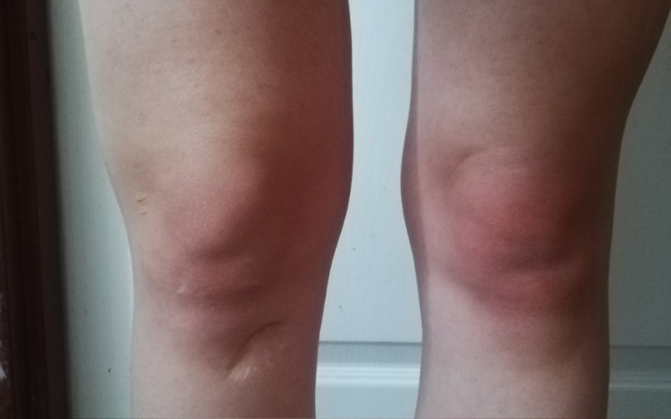 
        Zbiórka Czy pomożesz mi żyć normalnie - zdjęcie główne
    