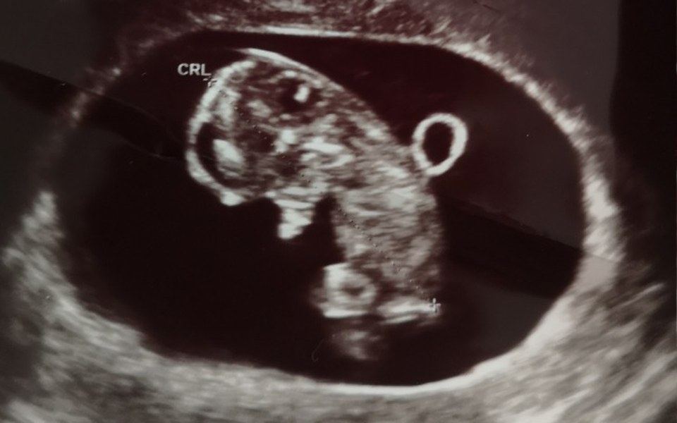 
        Zbiórka Walka o lepsze życie dla synka - zdjęcie główne
    