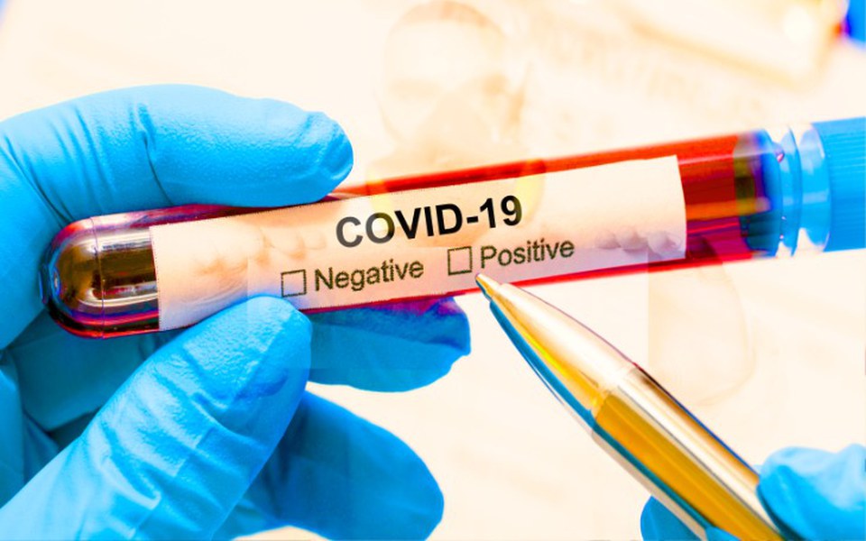 
        Zbiórka Zbiórka na koronawirusa - zdjęcie główne
    