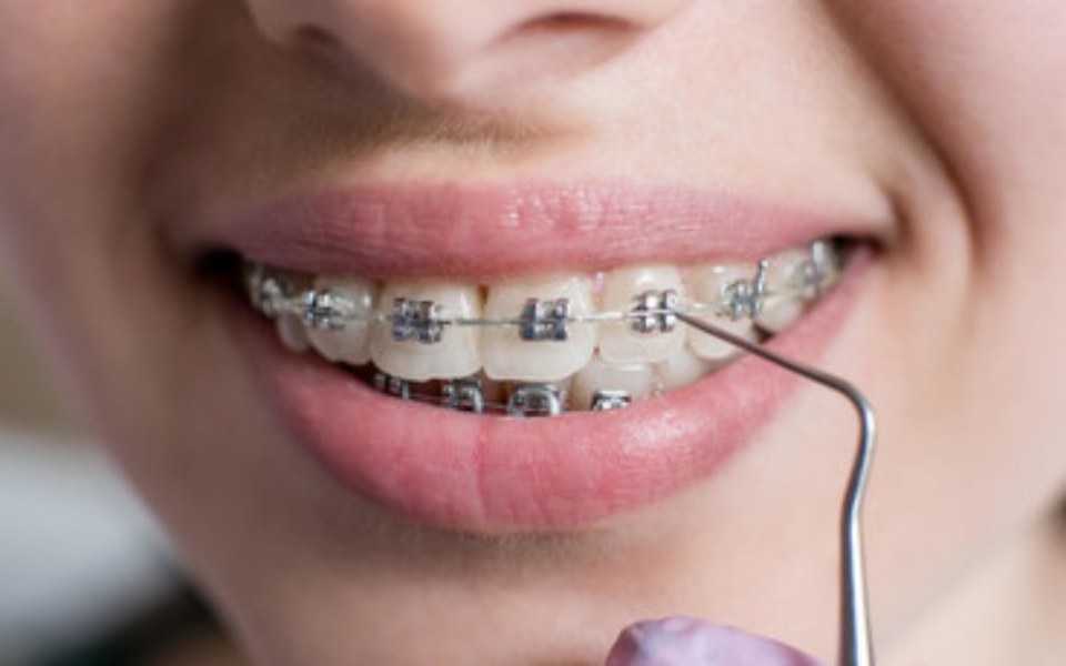 
        Zbiórka Pomoc W Leczeniu Wady Zgryzu - zdjęcie główne
    