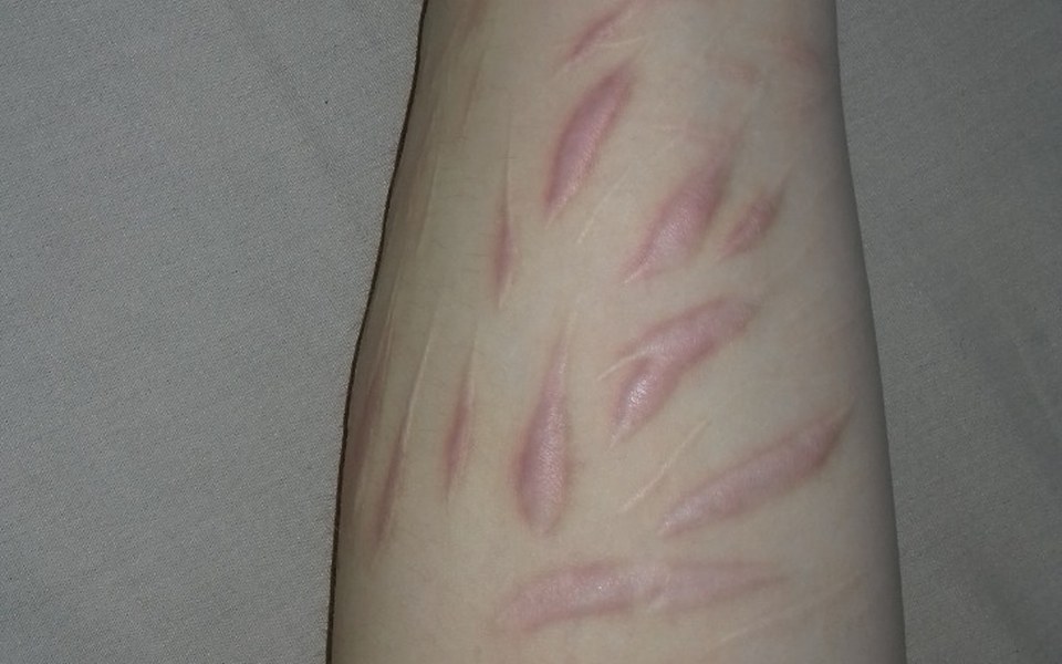 
        Zbiórka Pomóżmy Lenie - zdjęcie główne
    