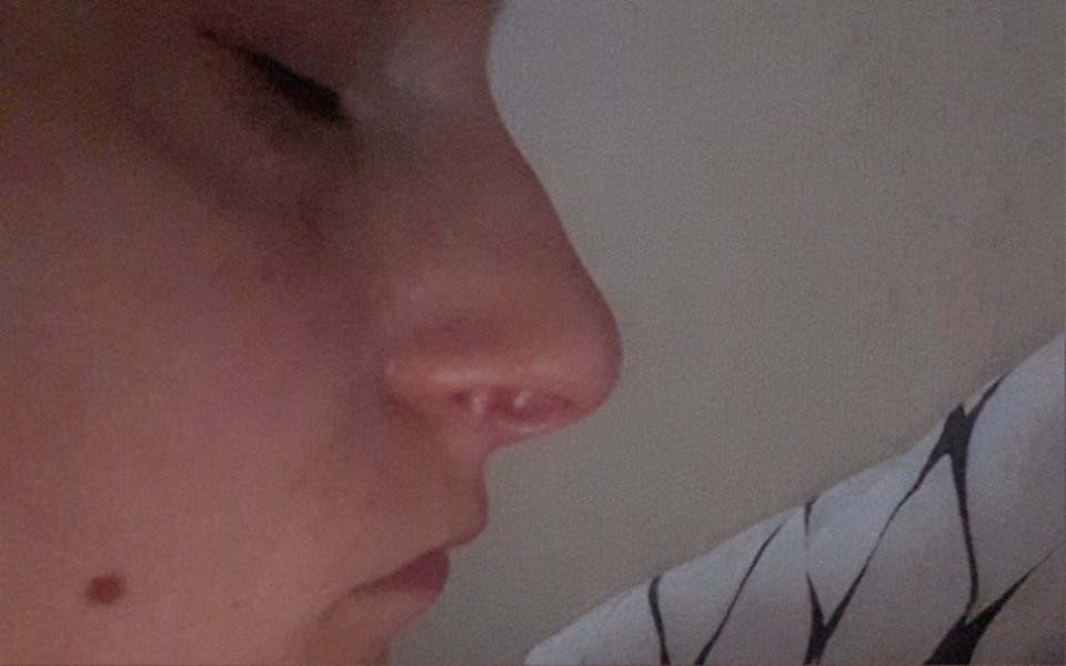 
        Zbiórka Korekta nosa i uszu - zdjęcie główne
    