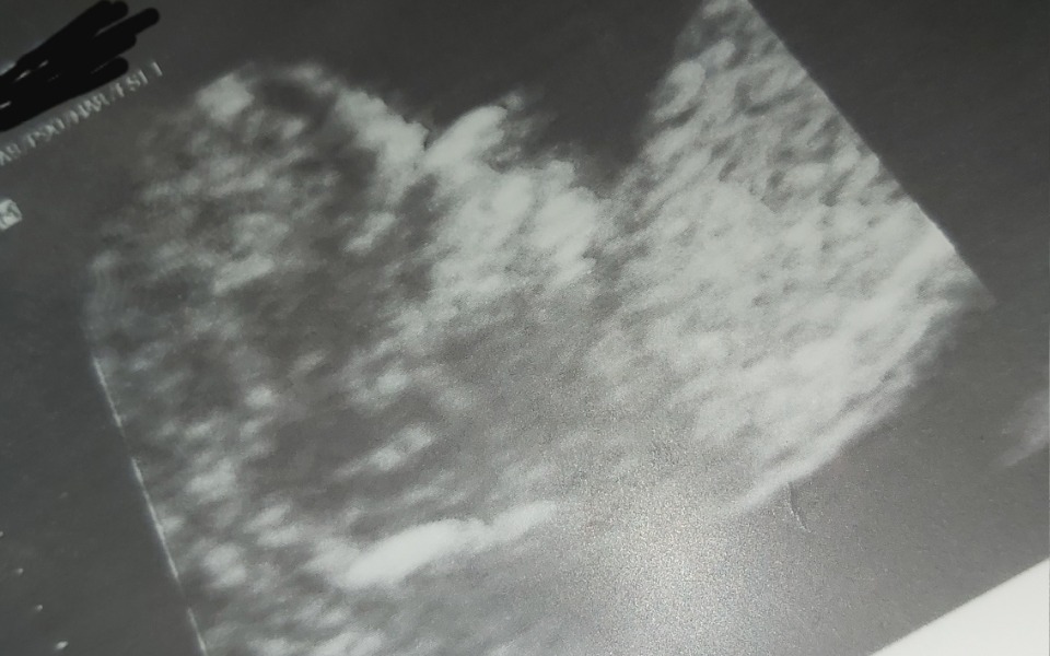 
        Zbiórka Dla potrzebującej matki - zdjęcie główne
    