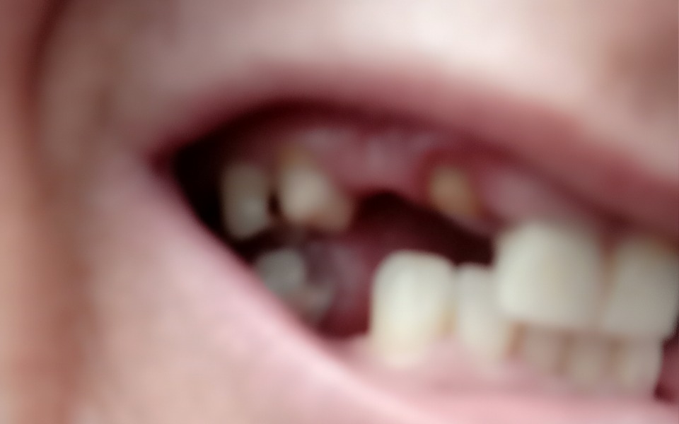 
        Zbiórka Pomóż mi mieć piękny uśmiech. - zdjęcie główne
    