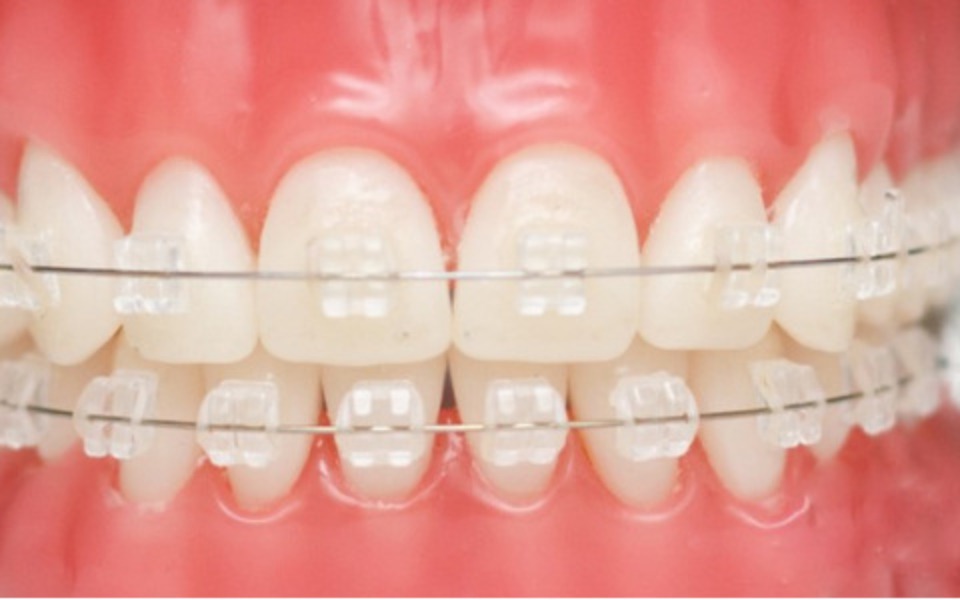 
        Zbiórka Dług za aparat ortodontyczny - zdjęcie główne
    