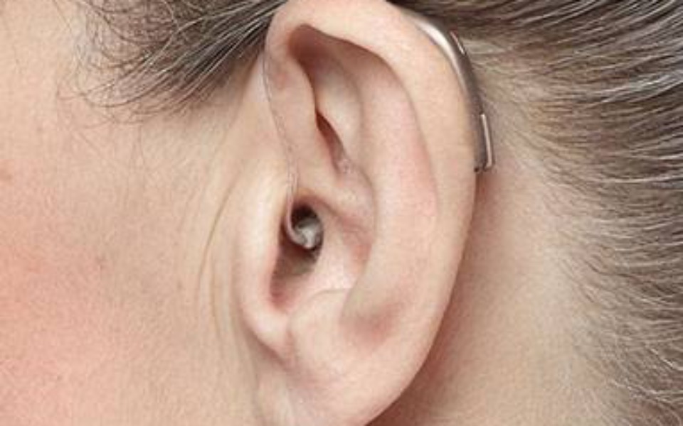 
        Zbiórka Aparat dla uszów - zdjęcie główne
    