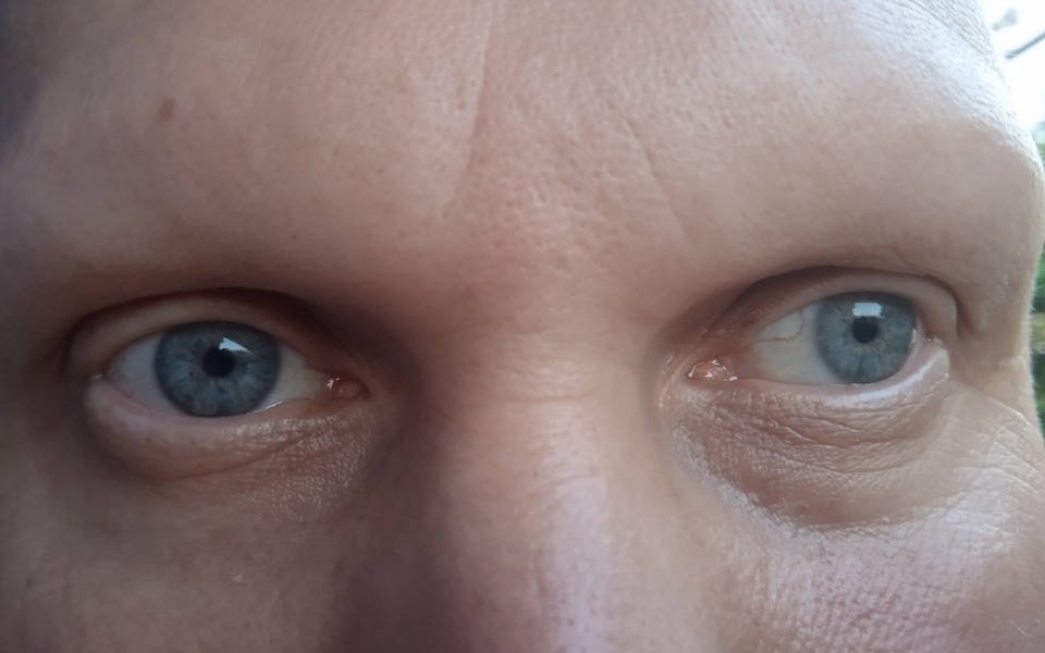 
        Zbiórka Leczenie hormonalne brak włosów - zdjęcie główne
    