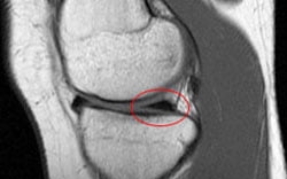 
        Zbiórka Operacja lewego kolana - zdjęcie główne
    